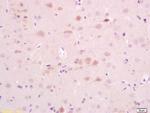 AKAP5 Antibody in Immunohistochemistry (Paraffin) (IHC (P))