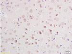 CLCN3 Antibody in Immunohistochemistry (Paraffin) (IHC (P))