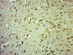 CLCN3 Antibody in Immunohistochemistry (Paraffin) (IHC (P))
