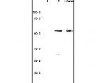 Wilms Tumor Protein Antibody in Western Blot (WB)
