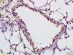 SAP62 Antibody in Immunohistochemistry (Paraffin) (IHC (P))