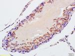 STK31 Antibody in Immunohistochemistry (Paraffin) (IHC (P))