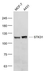 STK31 Antibody in Western Blot (WB)