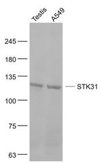 STK31 Antibody in Western Blot (WB)