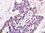 XAGE2 Antibody in Immunohistochemistry (Paraffin) (IHC (P))
