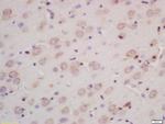 INPPL1 Antibody in Immunohistochemistry (Paraffin) (IHC (P))