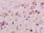 INPPL1 Antibody in Immunohistochemistry (Paraffin) (IHC (P))