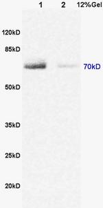 DENTT Antibody in Western Blot (WB)
