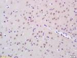 FTO Antibody in Immunohistochemistry (Paraffin) (IHC (P))