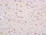 DEDD1 Antibody in Immunohistochemistry (Paraffin) (IHC (P))