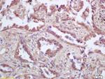 p53AIP1 Antibody in Immunohistochemistry (Paraffin) (IHC (P))