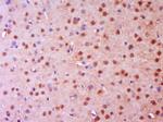 NGFR Antibody in Immunohistochemistry (Paraffin) (IHC (P))