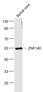 ZNF140 Antibody in Western Blot (WB)