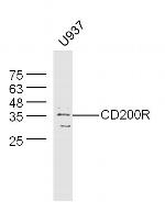 CD200R2 Antibody in Western Blot (WB)