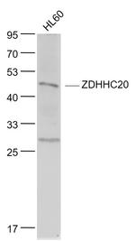 DHHC-20 Antibody in Western Blot (WB)