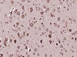 SPON1 Antibody in Immunohistochemistry (Paraffin) (IHC (P))