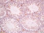 SOAT1 Antibody in Immunohistochemistry (Paraffin) (IHC (P))