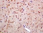 TNIP2 Antibody in Immunohistochemistry (Paraffin) (IHC (P))