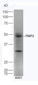 TNIP2 Antibody in Western Blot (WB)