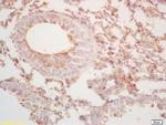 BCL2L14 Antibody in Immunohistochemistry (Paraffin) (IHC (P))