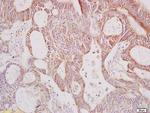 Galactosidase alpha Antibody in Immunohistochemistry (Paraffin) (IHC (P))