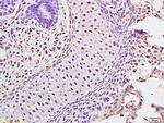 ATAD5 Antibody in Immunohistochemistry (Paraffin) (IHC (P))