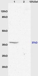 GPR55 Antibody in Western Blot (WB)