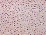 TSPYL5 Antibody in Immunohistochemistry (Paraffin) (IHC (P))
