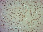 ZBTB2 Antibody in Immunohistochemistry (Paraffin) (IHC (P))