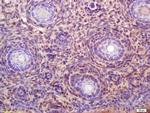 CDCA1 Antibody in Immunohistochemistry (Paraffin) (IHC (P))