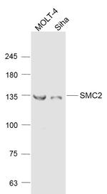 SMC2 Antibody in Western Blot (WB)
