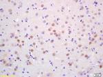 CDC10 Antibody in Immunohistochemistry (Paraffin) (IHC (P))