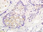 CEP55 Antibody in Immunohistochemistry (Paraffin) (IHC (P))