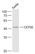 CEP55 Antibody in Western Blot (WB)