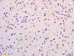 CHMP4B+CHMP4C Antibody in Immunohistochemistry (Paraffin) (IHC (P))
