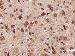 DCTN3 Antibody in Immunohistochemistry (Paraffin) (IHC (P))