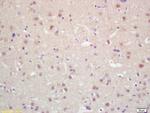 MKLP2 Antibody in Immunohistochemistry (Paraffin) (IHC (P))