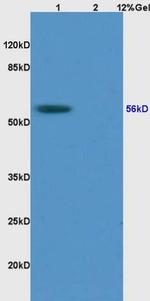 RCC2 Antibody in Western Blot (WB)