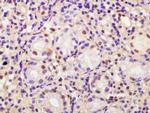 CDCA2 Antibody in Immunohistochemistry (Paraffin) (IHC (P))