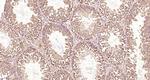 NUP37 Antibody in Immunohistochemistry (Paraffin) (IHC (P))