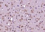 RABGAP1 Antibody in Immunohistochemistry (Paraffin) (IHC (P))