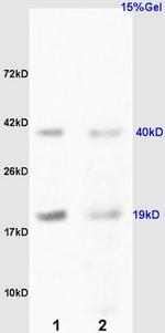 RCL Antibody in Western Blot (WB)