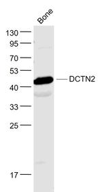 DCTN2 Antibody in Western Blot (WB)