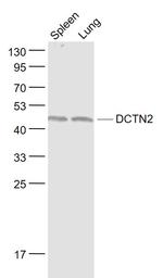 DCTN2 Antibody in Western Blot (WB)