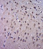 FAM3C Antibody in Immunohistochemistry (Paraffin) (IHC (P))