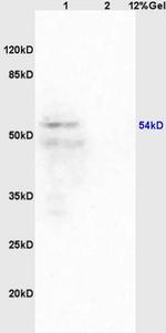 Iroquois homeobox protein 3 Antibody in Western Blot (WB)