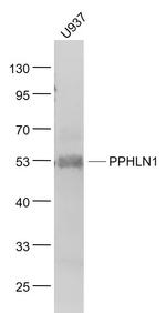 PPHLN1 Antibody in Western Blot (WB)