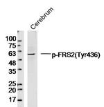 Phospho-FRS2 (Tyr436) Antibody in Western Blot (WB)