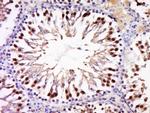 ANKRD28 Antibody in Immunohistochemistry (Paraffin) (IHC (P))