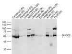 SHOC2 Antibody in Western Blot (WB)